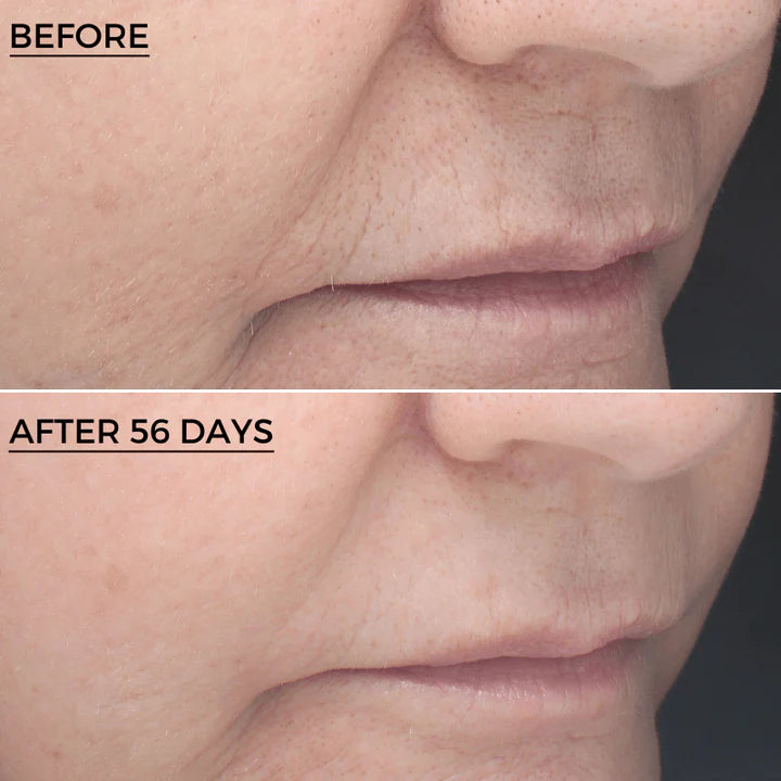 ÉJSZAKAI RETINOID Koncentrátum